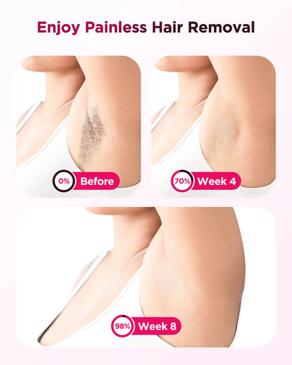 SmoothGlow™ At-Home Hair Removal Device™