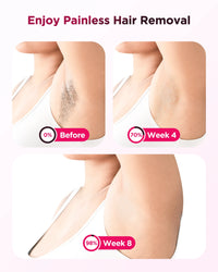 SmoothGlow™ At-Home Hair Removal Device™